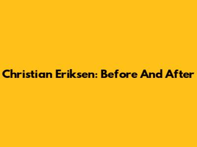 Christian Eriksen: Before And After