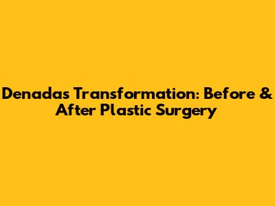 Denada's Transformation: Before & After Plastic Surgery