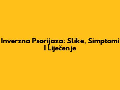 Inverzna Psorijaza: Slike, Simptomi I Liječenje