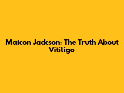 Maicon Jackson: The Truth About Vitiligo