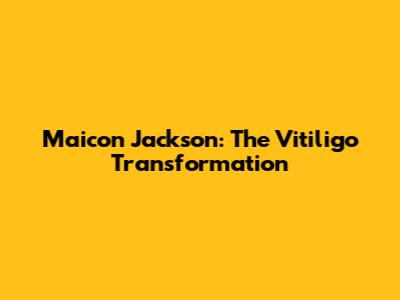 Maicon Jackson: The Vitiligo Transformation