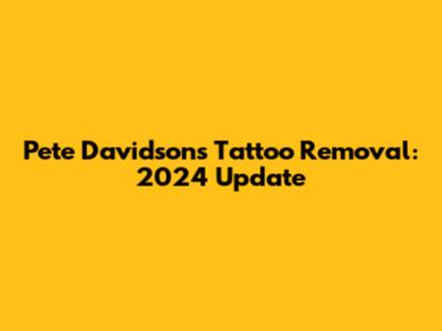 Pete Davidson's Tattoo Removal: 2024 Update
