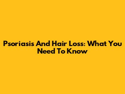 Psoriasis And Hair Loss: What You Need To Know