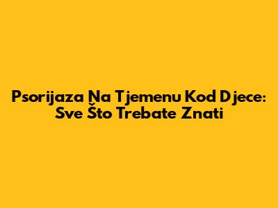 Psorijaza Na Tjemenu Kod Djece: Sve Što Trebate Znati