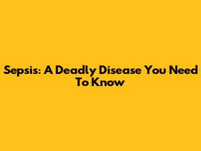 Sepsis: A Deadly Disease You Need To Know